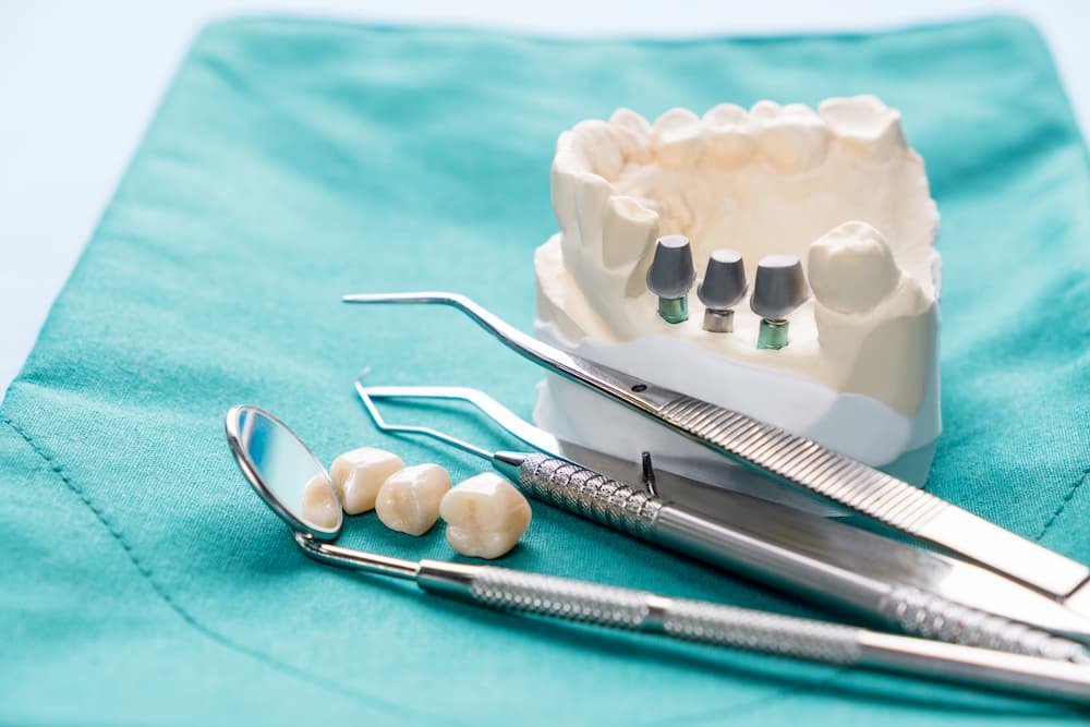 Implantate